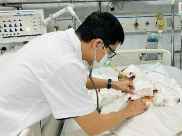 Bé trai ở Bắc Giang bị bỏng nặng vì máy tính phát nổ khi đang sử dụng