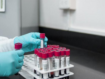 Con trai 26 tuổi có nhóm máu khác bố mẹ, cặp vợ chồng sốc nặng khi xét nghiệm ADN