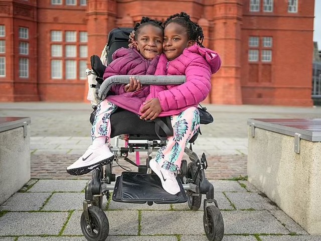 Tưởng vợ sinh một con nhưng lại là song sinh dính liền, ông bố chia sẻ: amp;#34;Thật may mắn khi làm bố của chúngamp;#34; - 1