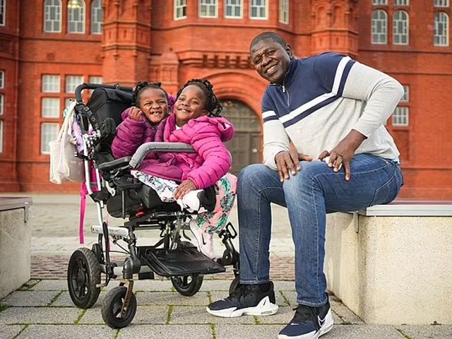 Tưởng vợ sinh một con nhưng lại là song sinh dính liền, ông bố chia sẻ: amp;#34;Thật may mắn khi làm bố của chúngamp;#34; - 2