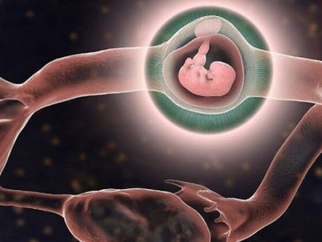 Trị sán lá gan, bất ngờ phát hiện chửa ngoài tử cung