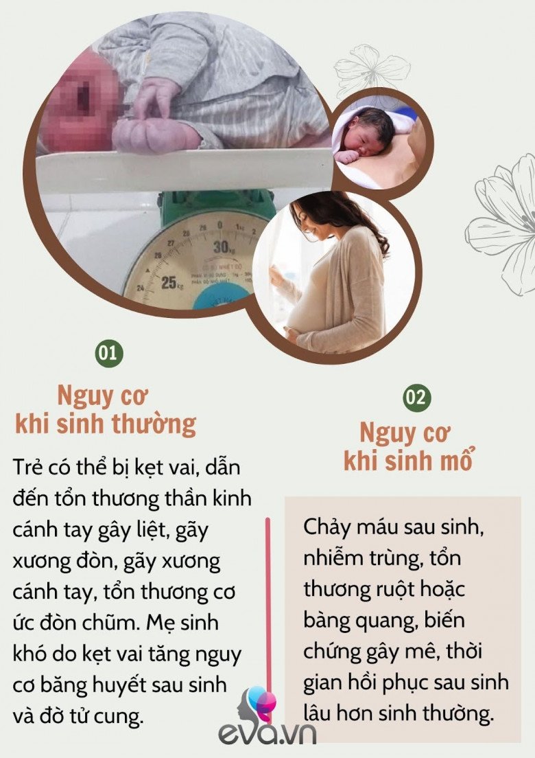 Thai to và những điều cần biết: Mẹ nên sinh thường hay sinh mổ chủ động? - 4