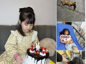 Bé gái đáng yêu bị chó chưa tiêm phòng dại cắn gây phẫn nộ cộng đồng mạng hiện giờ sức khỏe ra sao?