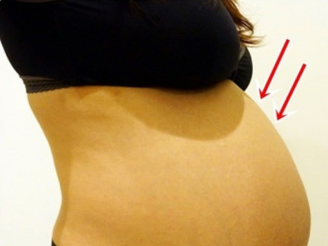 5 dấu hiệu chứng tỏ thai nhi đã di chuyển vào vùng xương chậu, sẵn sàng chào đời