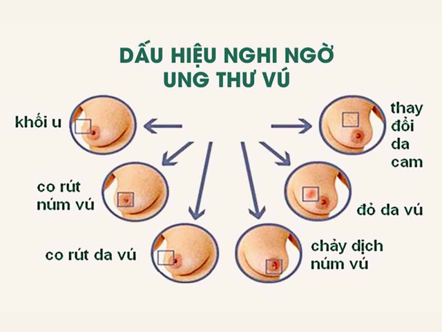 Dấu hiệu bệnh của Diva Hồng Nhung, chị em khuyên đừng chủ quan - 2