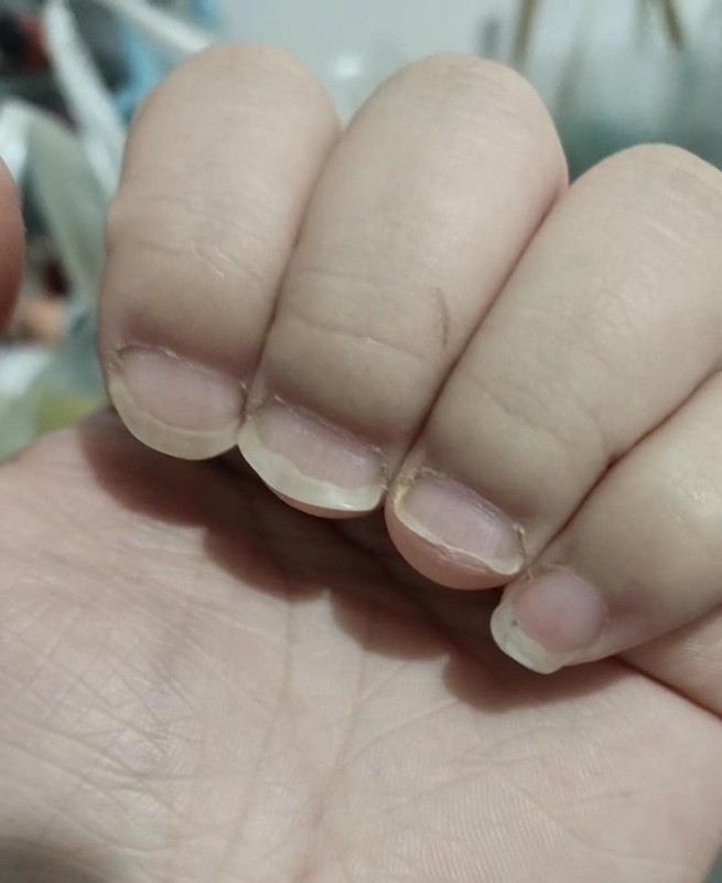 Trùm cuối của những mẫu nail độc lạ có lẽ thuộc về mẫu nail tự nhiên này. Dù chính chủ có lòng muốn làm đẹp ăn tết nhưng cũng không biết phải xử lý như thế nào được với hình dáng bộ móng tay đặc biệt của mình. (Ảnh: Tổng hợp Facebook)