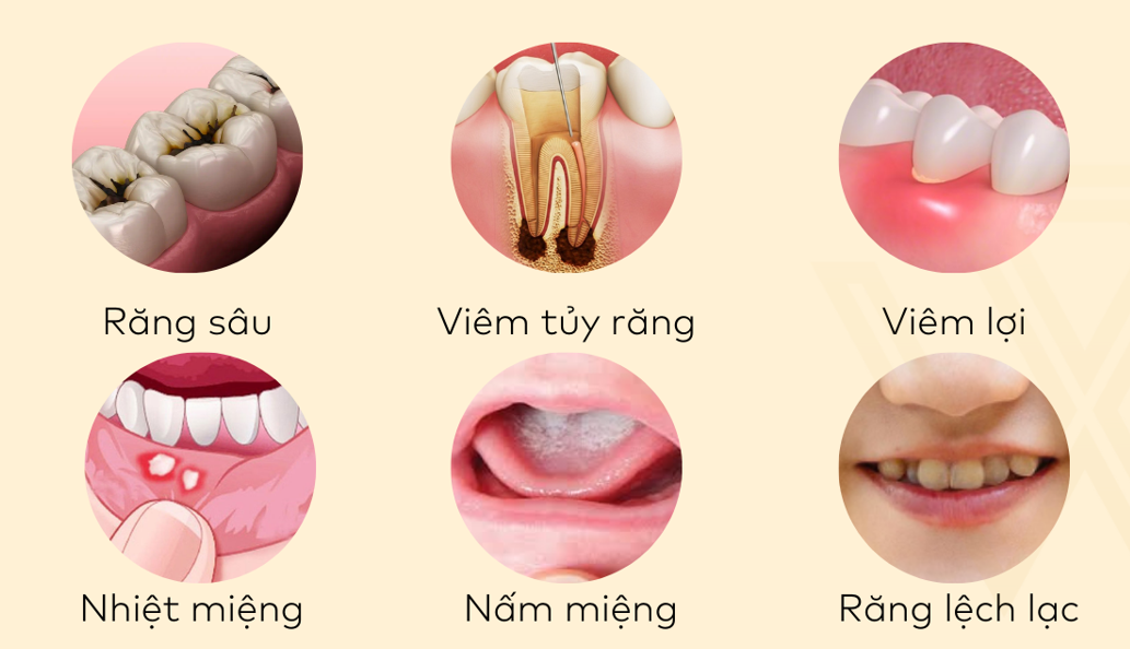 Theo Tổ chức Y tế Thế giới, người ta ước tính rằng các bệnh nha khoa ảnh hưởng đến gần 3,5 tỷ người trên toàn thế giới.