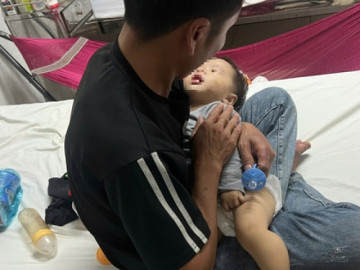 Công an xác minh thông tin bé 9 tháng tuổi bị bầm tím 2 má