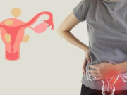 Bà bầu - Chảy máu khi rụng trứng có nguy hiểm không?