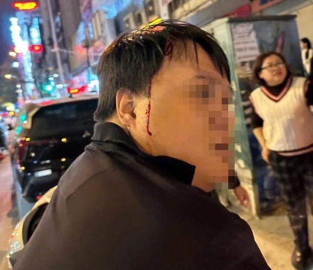 Nạn nhân bị thương tích ở đầu, chảy nhiều máu sau khi bị nhóm thanh niên tấn công. Ảnh: NDCC