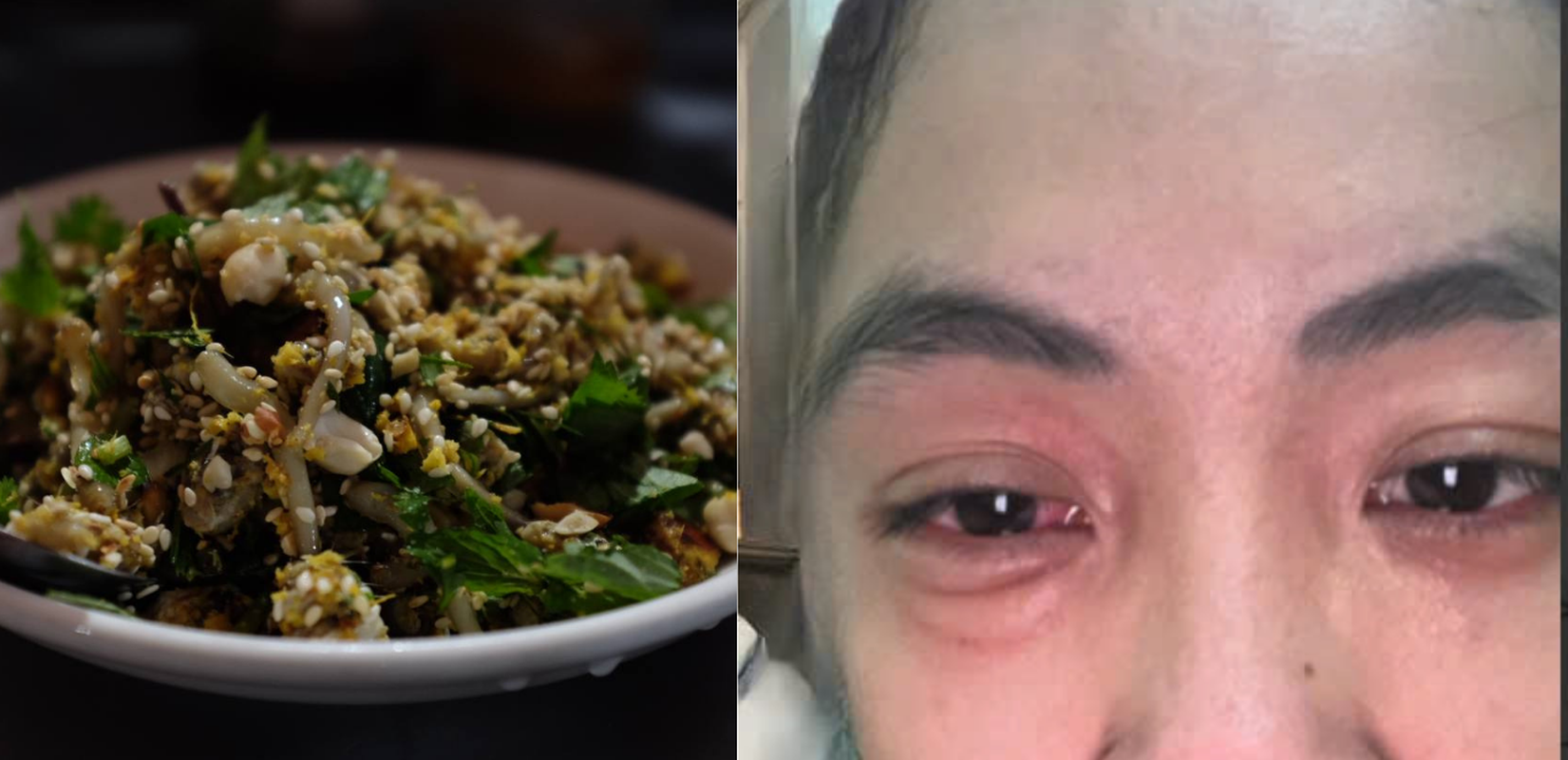 Tuy nhiên, không phải ai cũng thưởng thức đặc sản chân dài này được bởi một số người thưởng thức xong gặp tình trạng dở khóc dở cười mắt sưng húp, mẩn ngứa đầy người. Ảnh Đông Chí