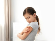 Sức khỏe - Nắng nóng gay gắt, trẻ dễ mắc các bệnh về da, cha mẹ cần lưu ý để tránh biến chứng nguy hiểm