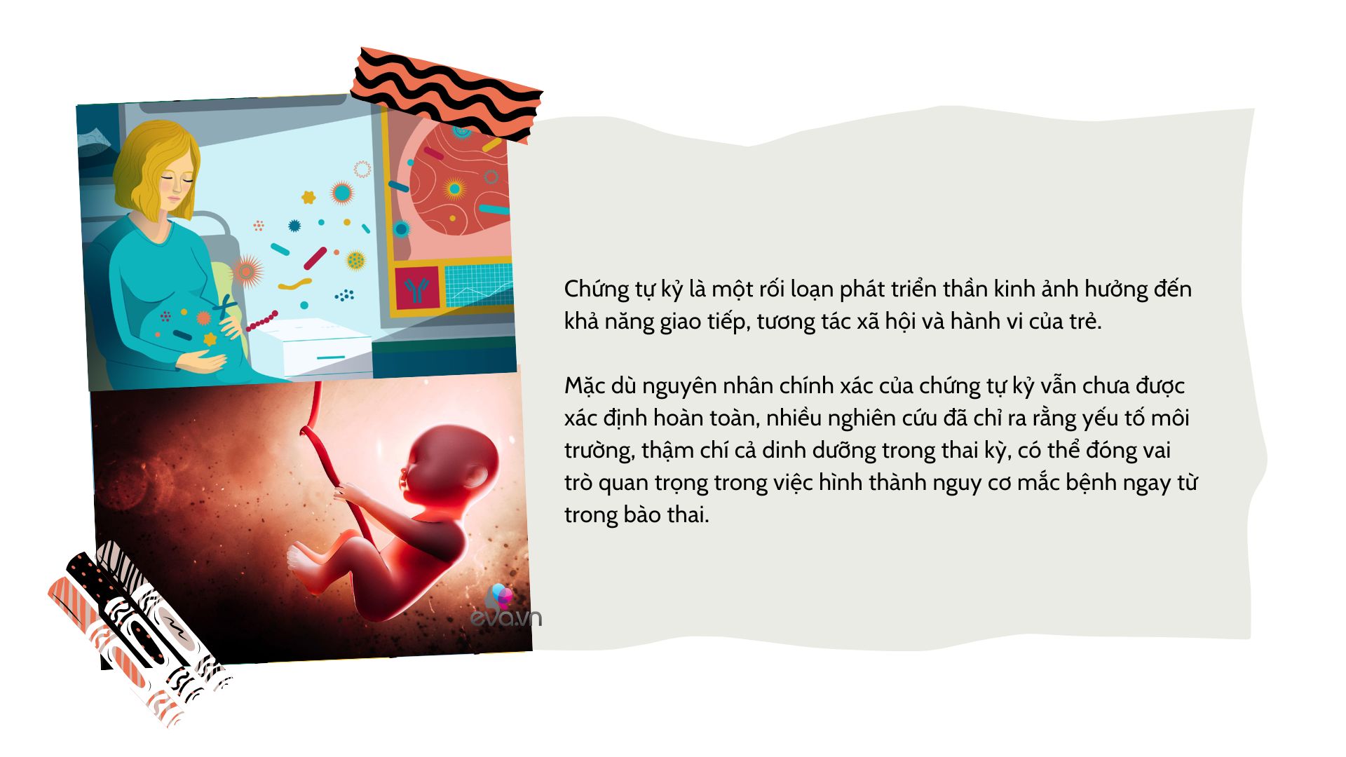 60.000 cặp mẹ - con đã chứng minh: Mẹ bầu vô tư ăn uống kiểu này, con có nguy cơ tự kỷ gấp đôi - 1