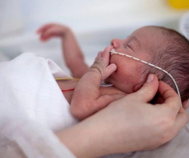 Sinh non gây nhiều biến chứng nghiêm trọng ở trẻ sơ sinh.