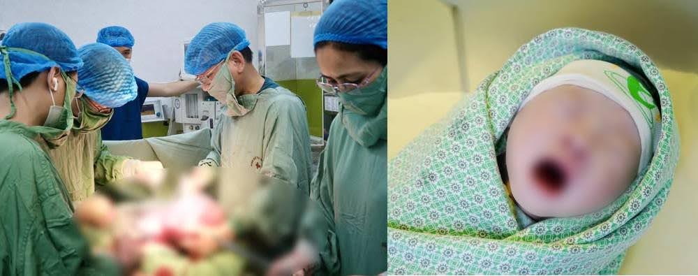 Em bé của chị T.T.H đã chào đời khỏe mạnh.