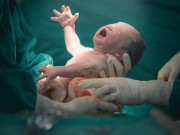 Bà bầu - Sinh mổ ngoài ý muốn có thể làm tăng nguy cơ trầm cảm sau sinh