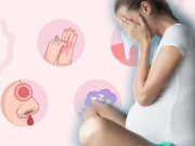 Bà bầu - Góc bất ngờ: 25 triệu chứng xuất hiện khi mang thai tưởng lạ nhưng lại rất bình thường