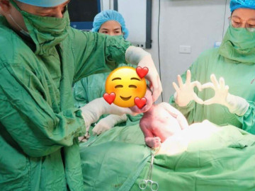 Em bé nặng 3.2kg chào đời cùng vòng tránh thai của mẹ