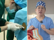 Bà bầu - Bác sĩ sản khoa tiết lộ sự thật về sinh mổ, nói một câu khiến ai cũng đồng tình