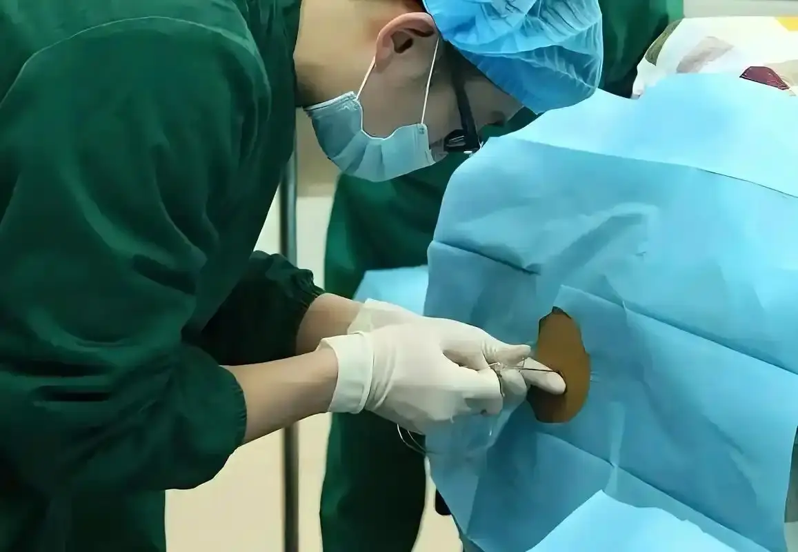 Sau khi gây tê, mẹ sẽ cảm nhận được áp lực nhưng không thấy đau.