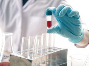 Sức khỏe - Người thuộc nhóm máu nào lâu già và sống thọ nhất? May mắn lắm bạn mới có được điều này