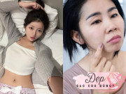 Đẹp - Ngủ tư thế này khiến nếp nhăn ngày càng sâu, chuyên gia chỉ cách ngủ đúng để da căng mịn, trẻ lâu