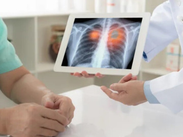 Một gia đình có nhiều người qua đời vì ung thư thừa nhận một thói quen nhiều người Việt mắc phải