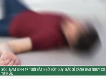 Sốc: Nam sinh 17 tuổi bất ngờ đột quỵ, bác sĩ cảnh báo nguy cơ tiềm ẩn