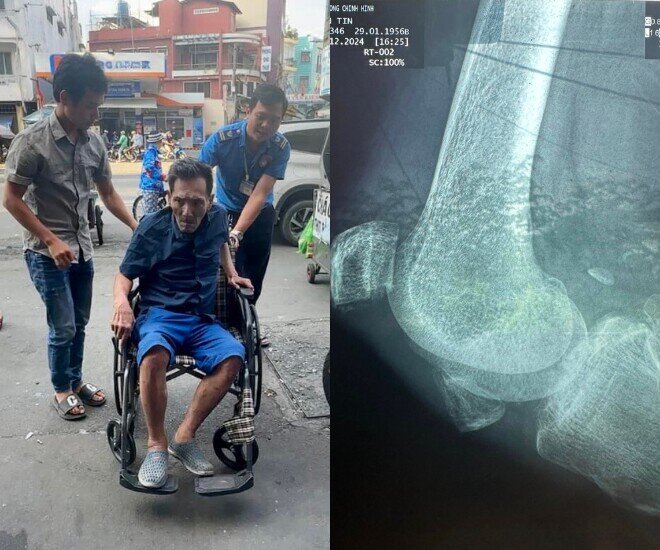 Thương Tín bị tai nạn nhưng không điều trị kịp thời, đối diện với nguy cơ thương tật vĩnh viễn.