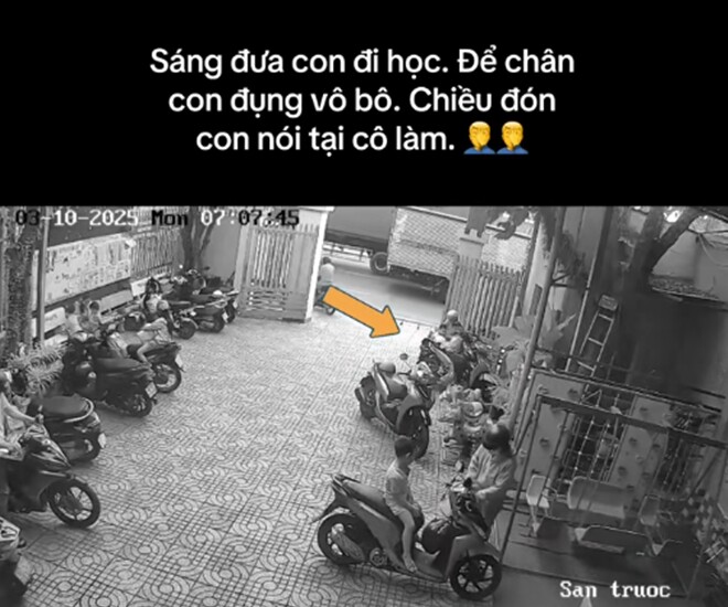 Con đi học về chân bị bỏng rộp, mẹ đi kiện nhưng amp;#34;câm nínamp;#34; khi thấy cô giáo gửi camera giám sát - 1