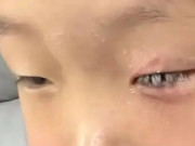 Yêu con - Con bị keo 502 bắn vào mắt, dính chặt không thể gỡ, mẹ lập tức đổ thêm 1 thứ vào, BS khen nức nở