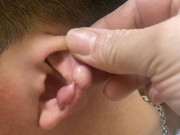 Sức khỏe - Đua nhau làm đẹp để đổi vận đón Tết nhằm hút tài lộc, nhiều “nam thanh - nữ tú” nhận cái kết đắng lòng