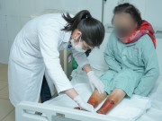 Sức khỏe - Người phụ nữ ở Thái Bình nhập viện vì dùng bột lá cây để ngâm chân giữ ấm trong mùa đông