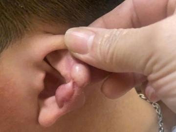 Đua nhau làm đẹp để đổi vận đón Tết nhằm hút tài lộc, nhiều “nam thanh - nữ tú” nhận cái kết đắng lòng