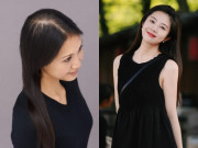 Đẹp - Tóc rụng thưa sắp hói, chị em 40+ áp dụng 5 phương pháp đơn giản này để "đảo ngược" tình trạng