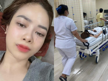 Dương Hoàng Yến môi méo, sưng mặt vì liệt dây thần kinh số 7