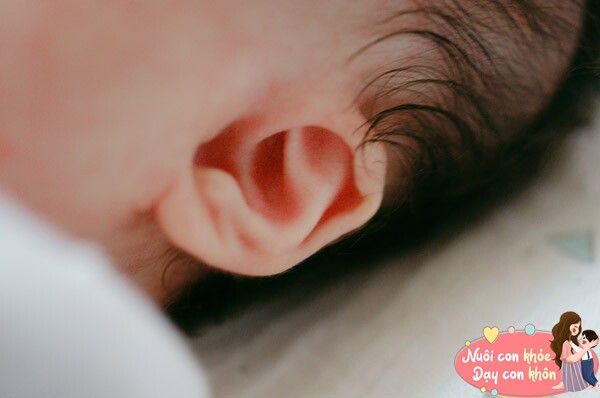 Trẻ em tai to và dái tai dày thường có khả năng nghe tốt.