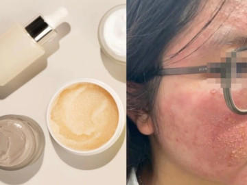 Cô gái Hà Nội cầu cứu bác sĩ sau món quà Valentine của bạn trai