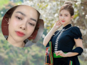 Sức khỏe - Ca sĩ Dương Hoàng Yến phát hiện bị méo mặt phải vào viện gấp: Bệnh nguy hiểm thế nào, có dễ điều trị không?