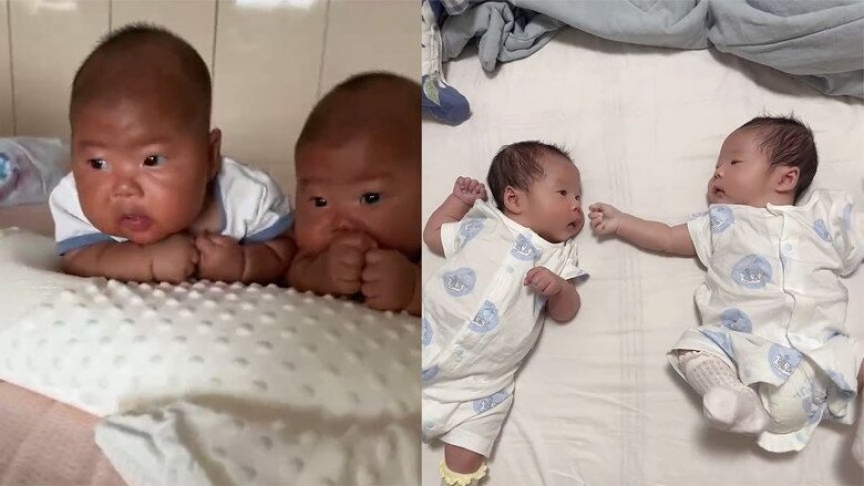 Làn da của cặp sinh đôi thay đổi nhanh chóng sau 1 tháng khiến ai cũng ngạc nhiên.