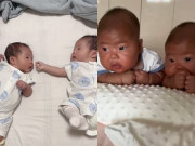 Yêu con - Cặp song sinh chào đời da trắng bóc, 1 tháng sau bỗng đen như than, biết nguyên nhân ai cũng chỉ trích bố mẹ