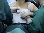 Yêu con - Mẹ thấy ngực con gái 13 tuổi sưng đỏ, đưa đến bệnh viện bác sĩ phát hiện nhiều vụn giấy kỳ lạ