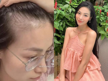 Hoa hậu Phương Khánh thoát khỏi ám ảnh tóc rụng, nhờ loại thảo dược chị em từ Đông sang Tây rần rần tìm kiếm