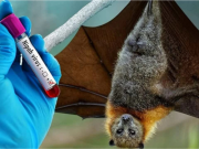 Clip Eva - 2 phút hiểu về Nipah: Virus có thể gây đại dịch