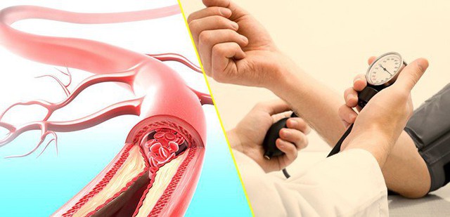 Kiểm soát được huyết áp - đường huyết - mỡ máu sẽ giúp bạn có tuổi thọ cao hơn. Ảnh minh họa