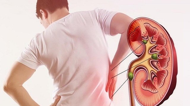 Thận khỏe là gốc rễ của trường thọ. Ảnh minh họa