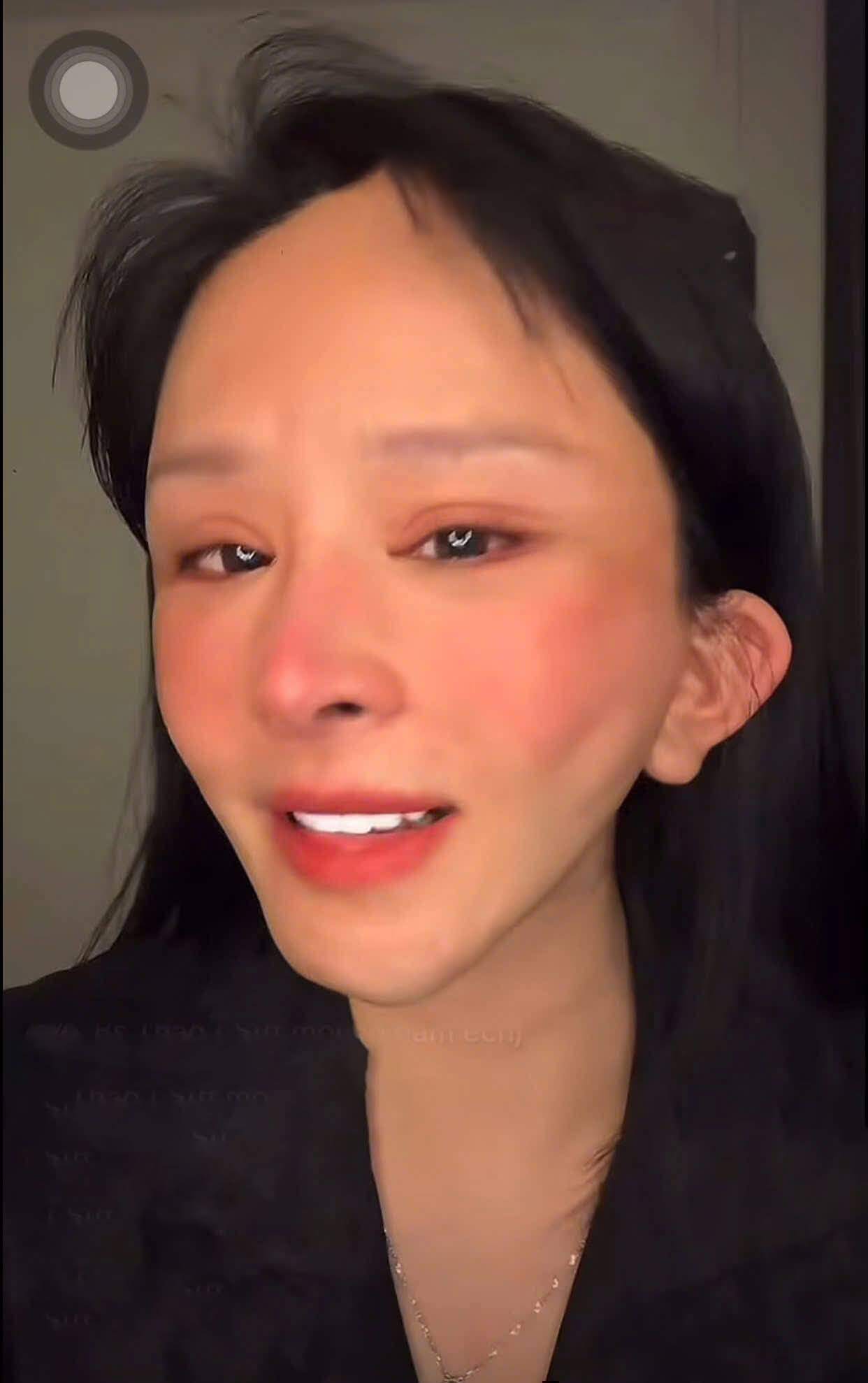 Nhan sắc trước và sau khi thẩm mỹ của cô gái khiến nhiều người tiếc nuối.