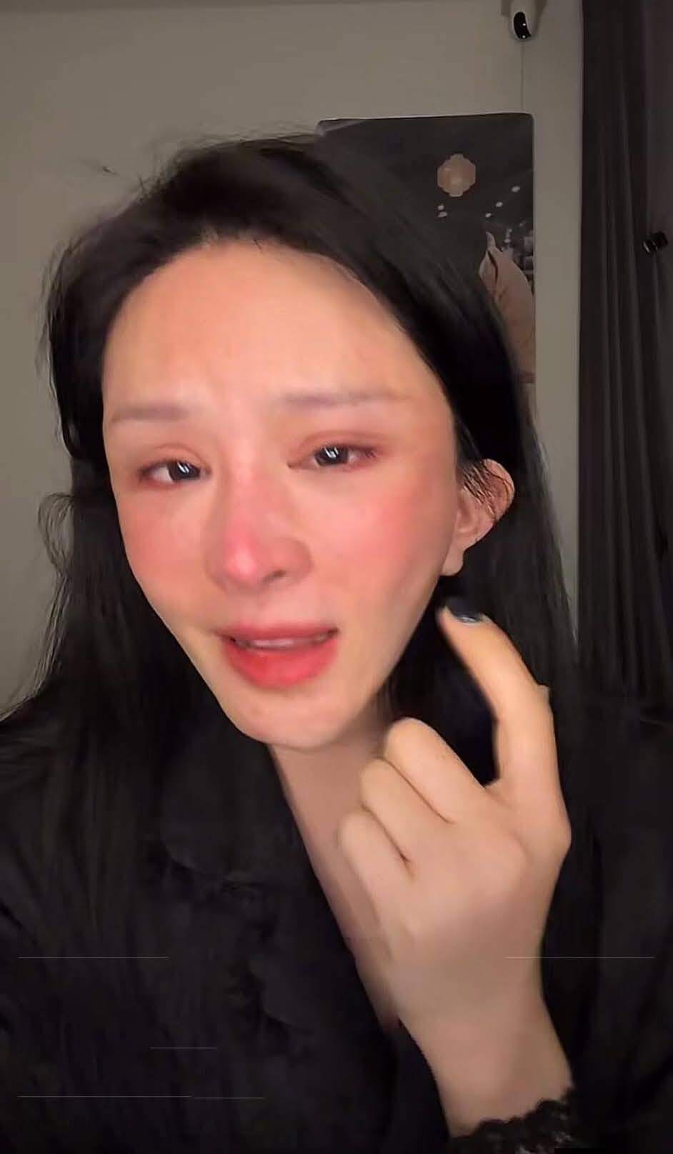 Cô gái lên livestream khóc lóc kể về việc bị biến dạng mặt sau thẩm mỹ. 