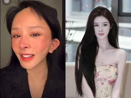 Đẹp - Mạng xã hội "dậy sóng" với cô gái livestream khóc lóc giữa đêm vì gương mặt biến dạng sau khi thẩm mỹ