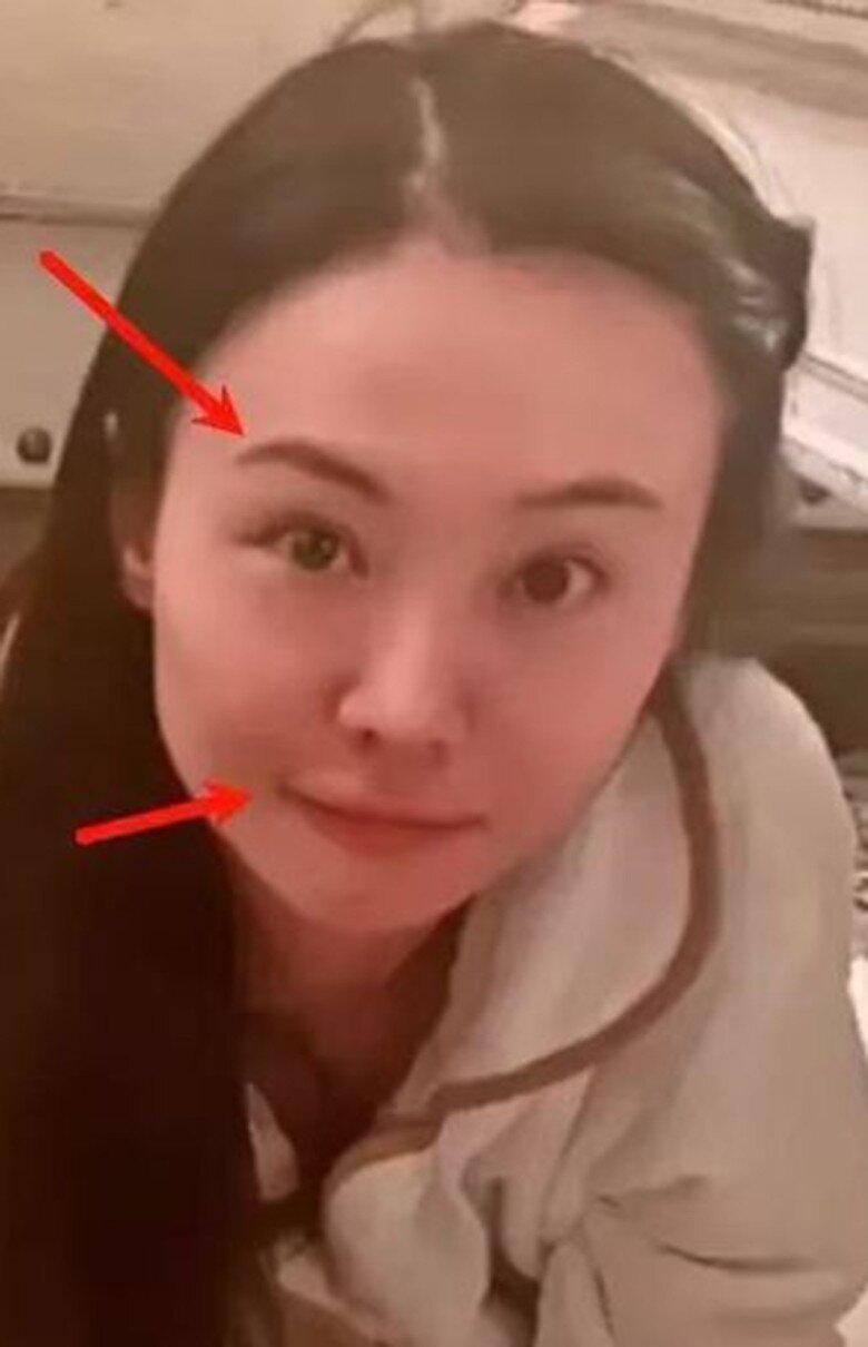 Phần lông mày cứng đờ và đôi môi ếch khiến nhiều người tin rằng cô lạm dụng thẩm mỹ đến biến dạng.